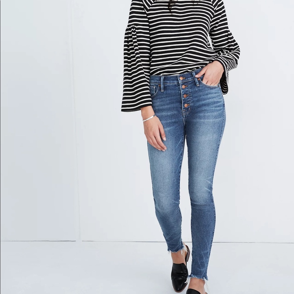 Madewell Button Front High Rise Skinny